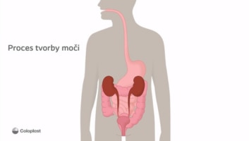 Proces tvorby moči